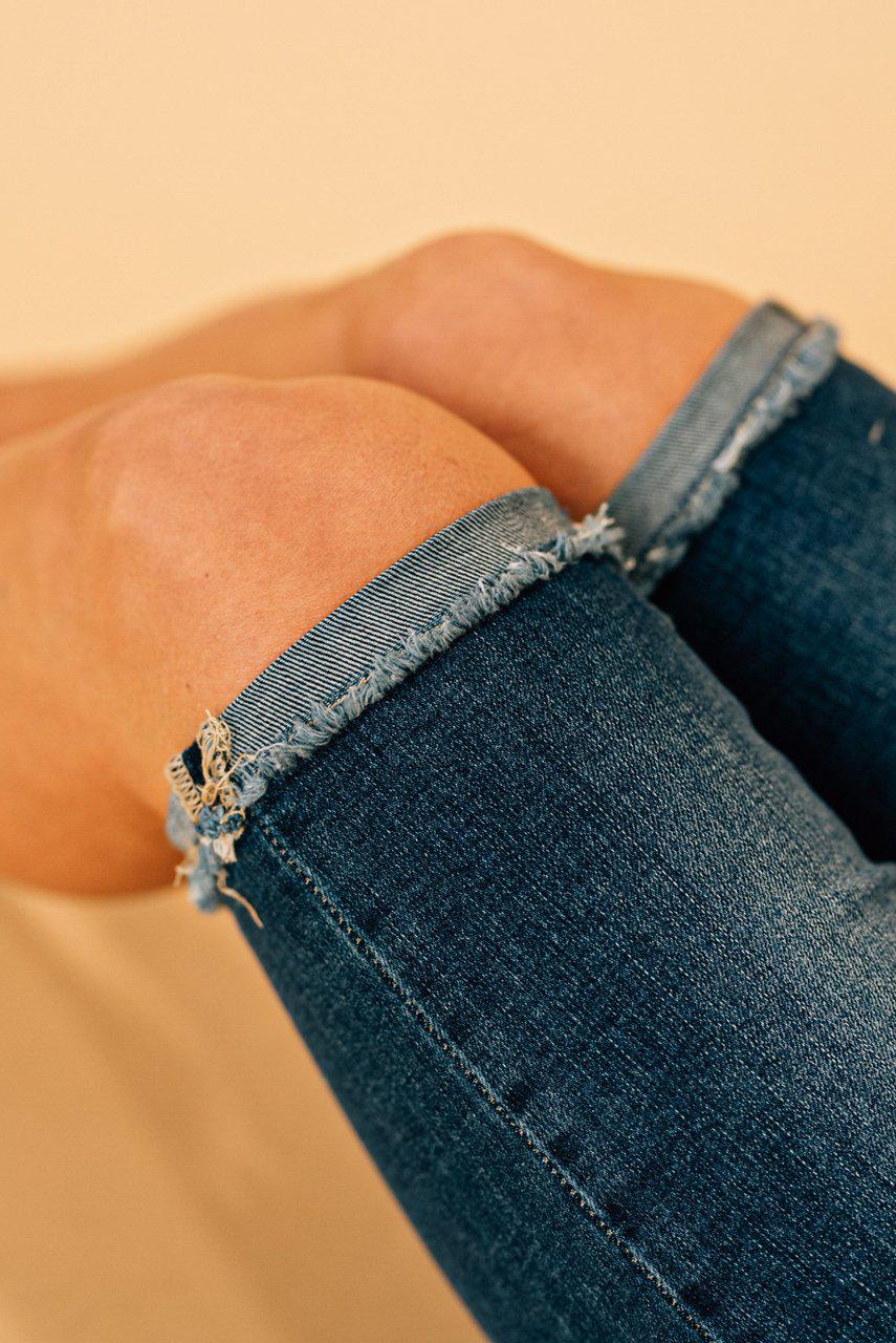 frayed edge bermuda shorts